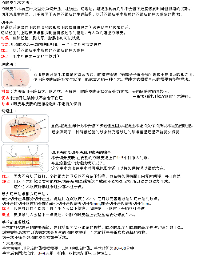 双眼手术